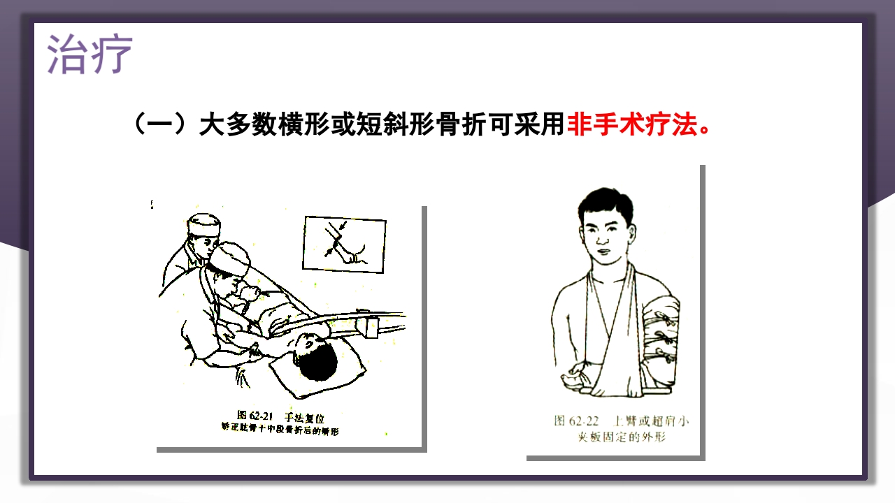 上肢骨关节损伤PPT课件32