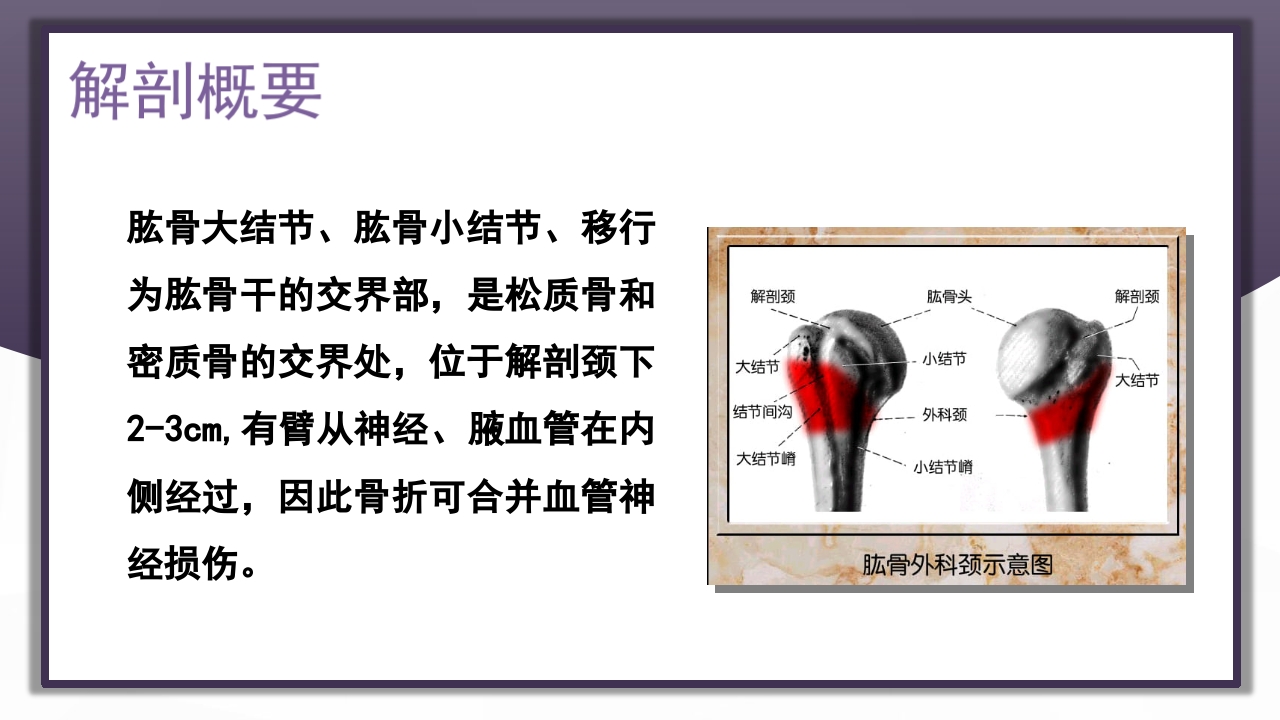 上肢骨关节损伤PPT课件36