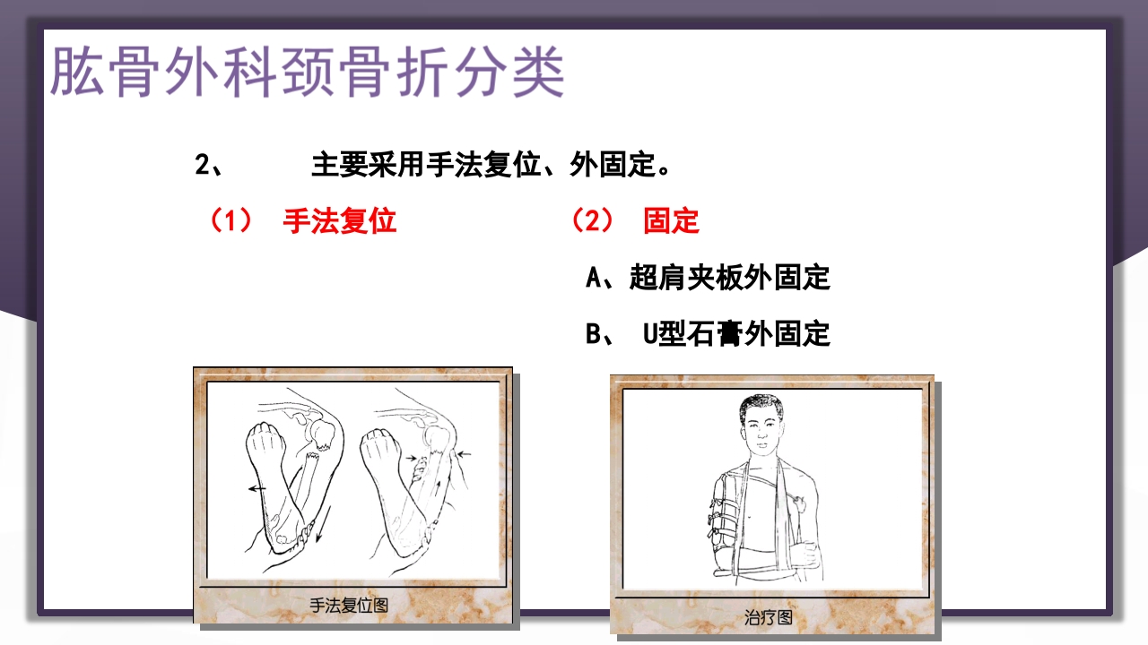 上肢骨关节损伤PPT课件39