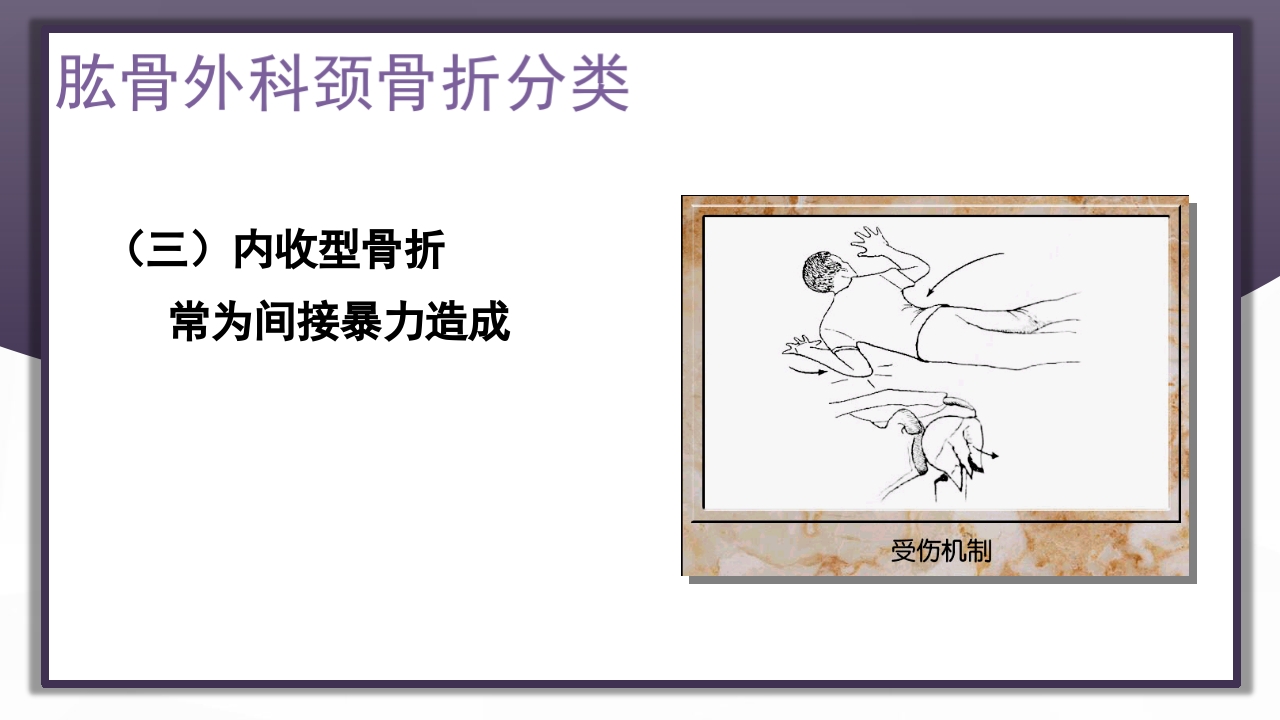 上肢骨关节损伤PPT课件40