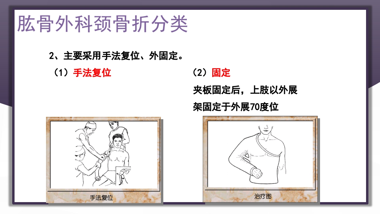 上肢骨关节损伤PPT课件42
