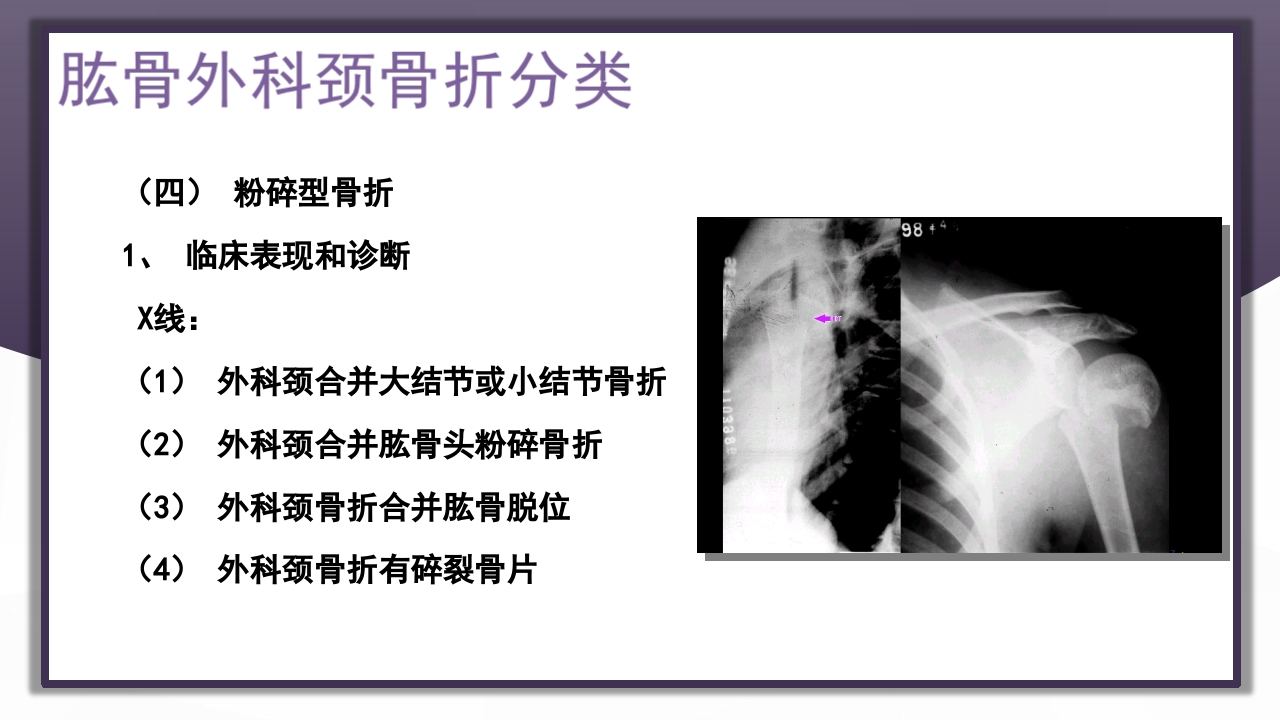 上肢骨关节损伤PPT课件43