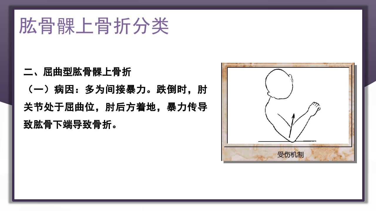 上肢骨关节损伤PPT课件54