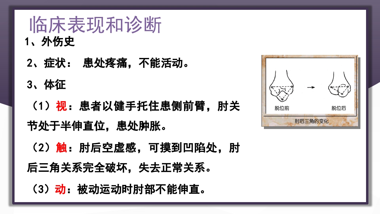 上肢骨关节损伤PPT课件60