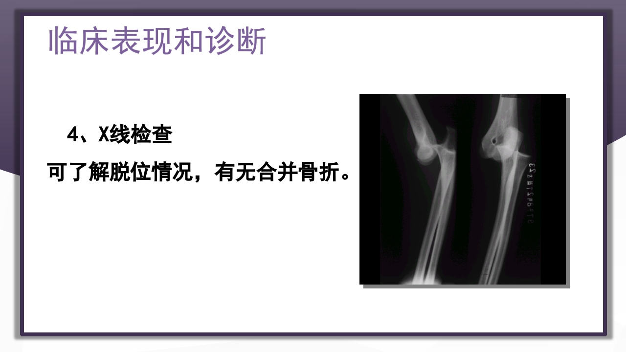 上肢骨关节损伤PPT课件61