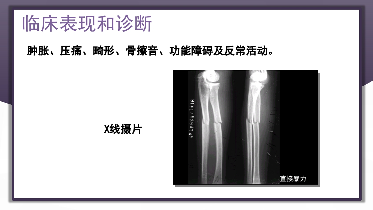 上肢骨关节损伤PPT课件66