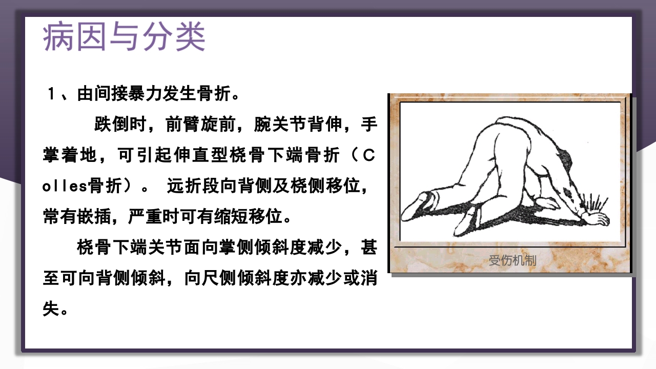 上肢骨关节损伤PPT课件70