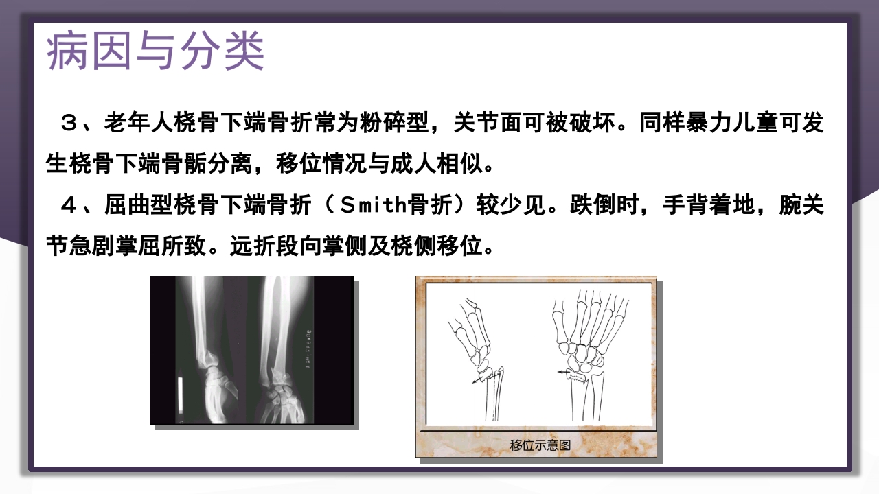 上肢骨关节损伤PPT课件72