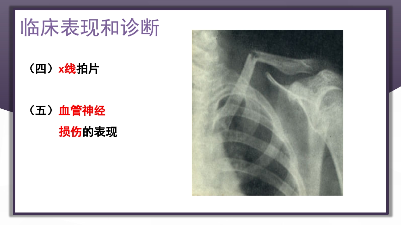 上肢骨关节损伤PPT课件8