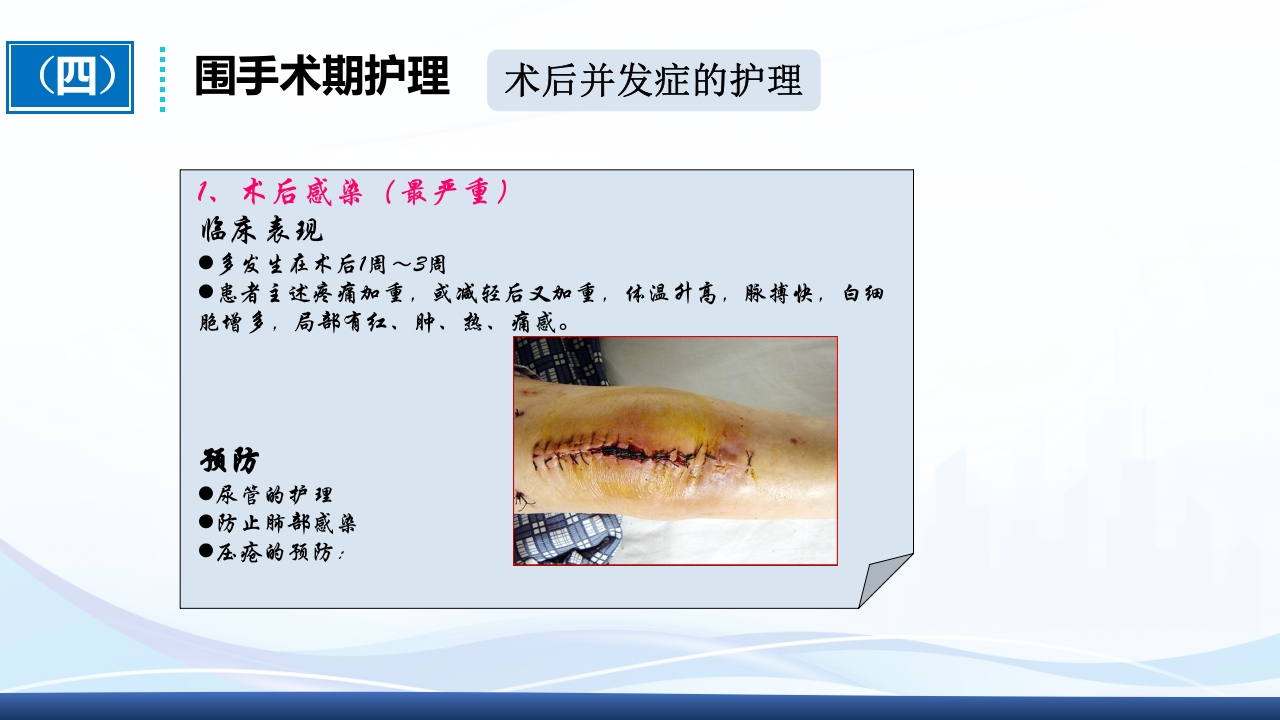 全膝关节置换术围手术期护理ppt课件29