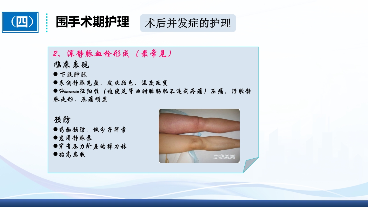 全膝关节置换术围手术期护理ppt课件30