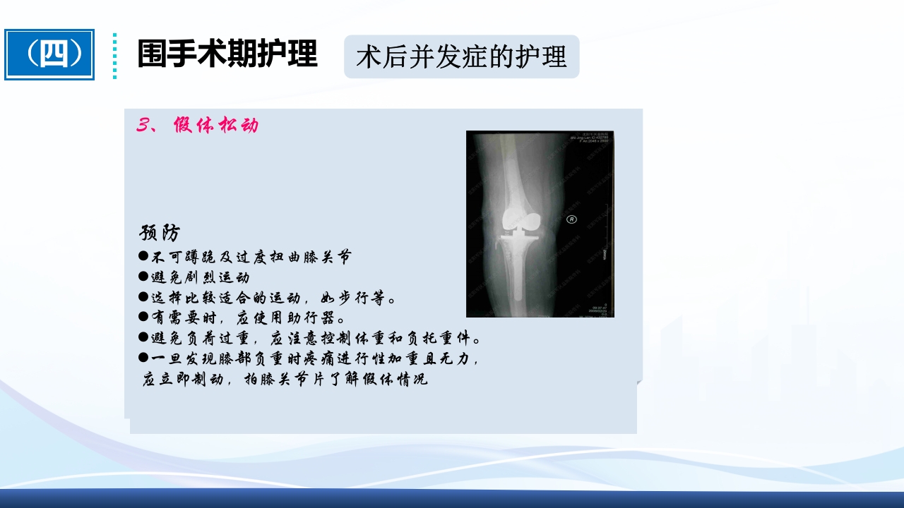 全膝关节置换术围手术期护理ppt课件31