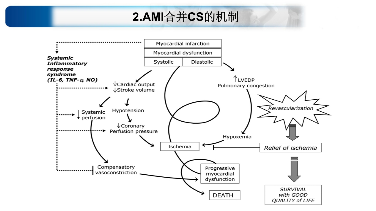 心源性休克诊治思路与进展ppt课件11