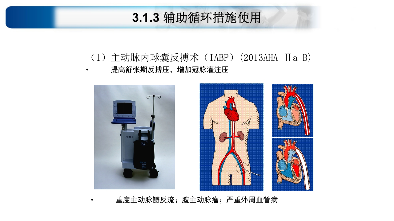心源性休克诊治思路与进展ppt课件26