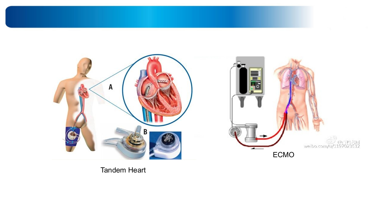 心源性休克诊治思路与进展ppt课件28