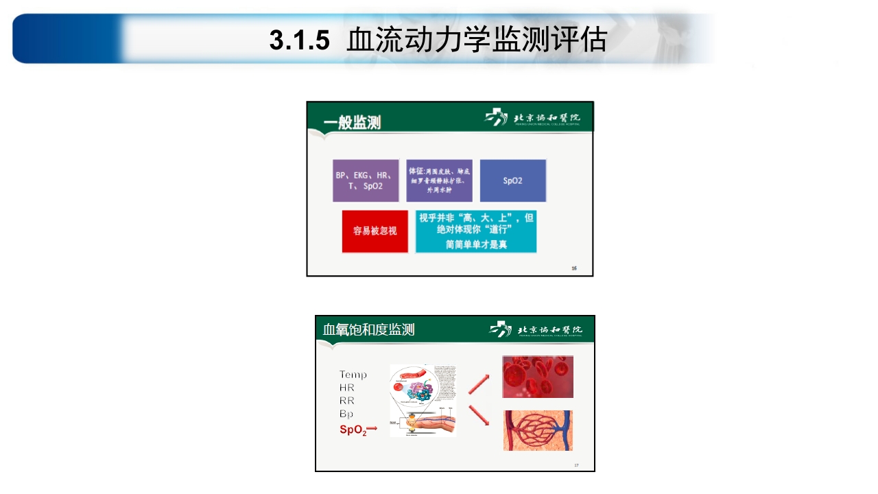 心源性休克诊治思路与进展ppt课件32