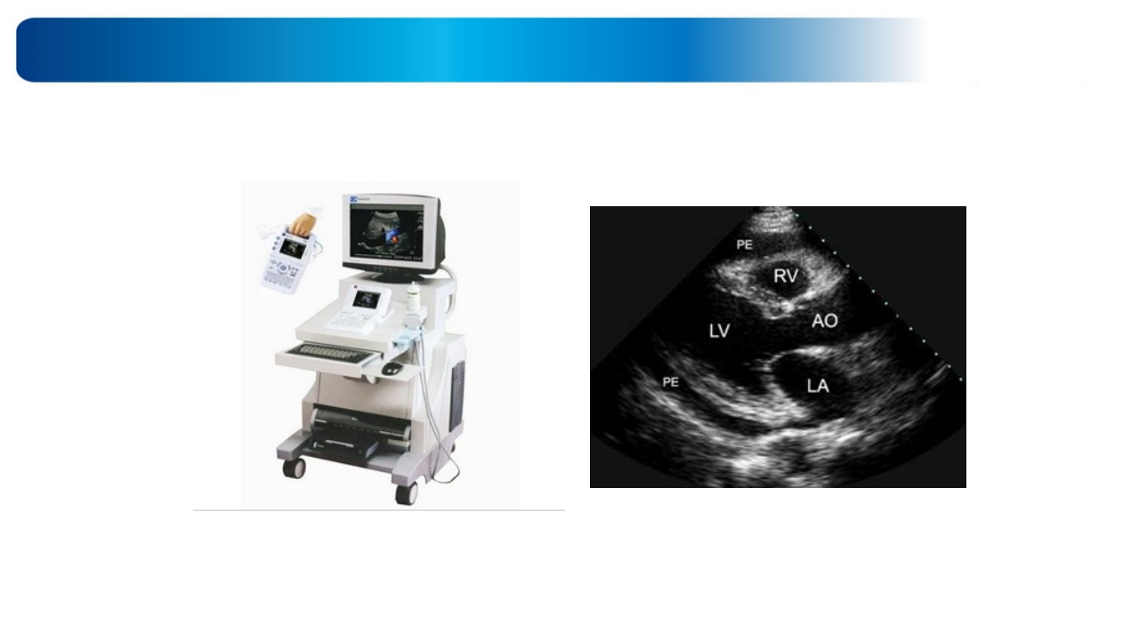 心源性休克诊治思路与进展ppt课件34