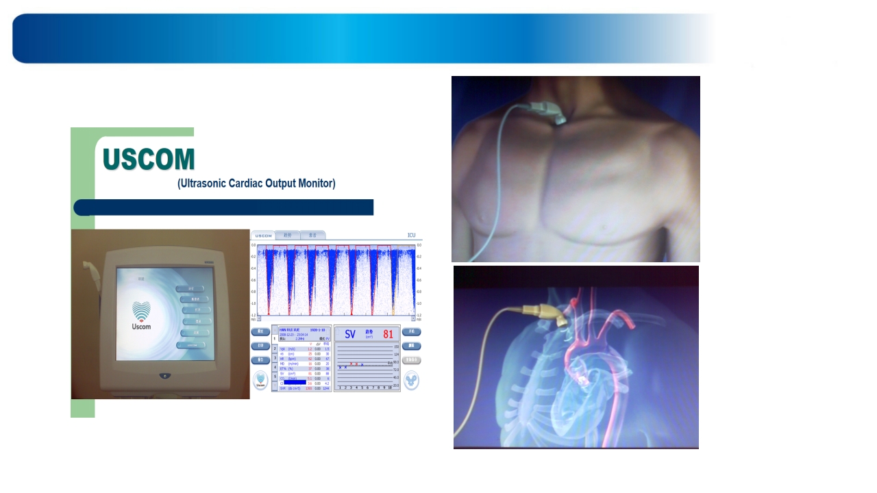 心源性休克诊治思路与进展ppt课件35