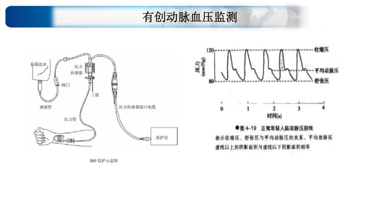 心源性休克诊治思路与进展ppt课件36