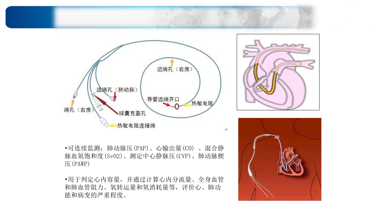 心源性休克诊治思路与进展ppt课件39
