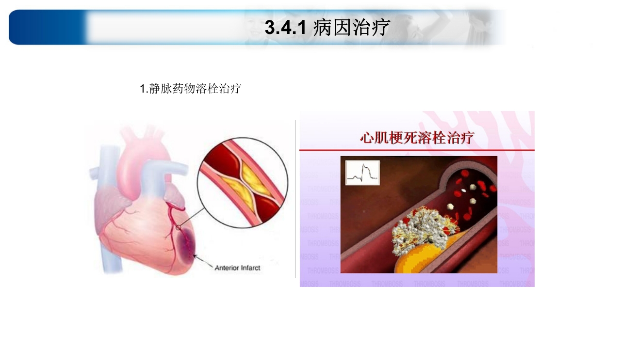 心源性休克诊治思路与进展ppt课件48