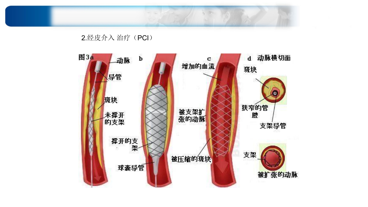心源性休克诊治思路与进展ppt课件49