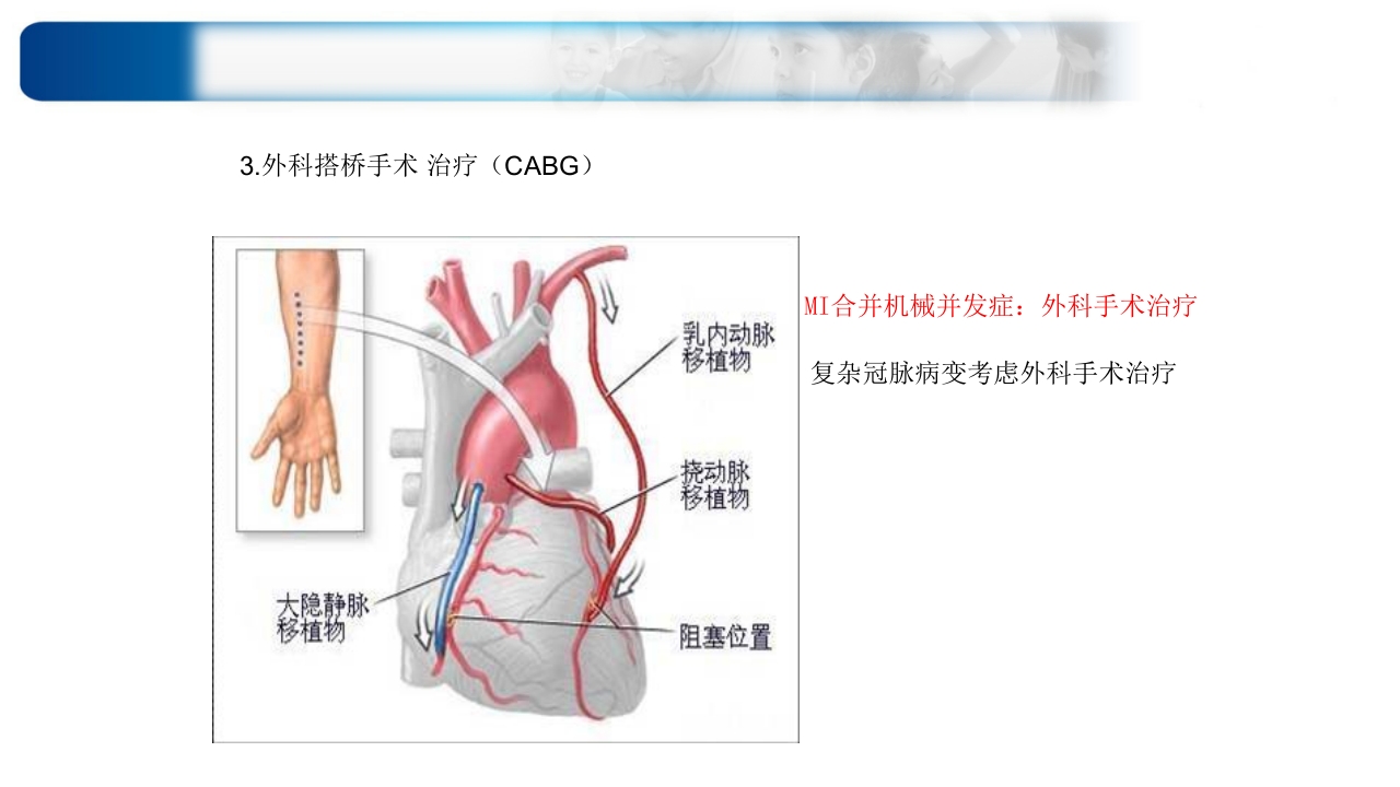 心源性休克诊治思路与进展ppt课件50