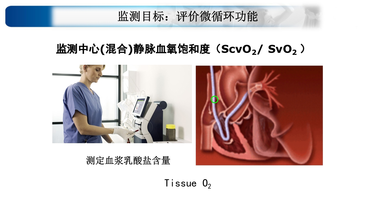 心源性休克诊治思路与进展ppt课件52