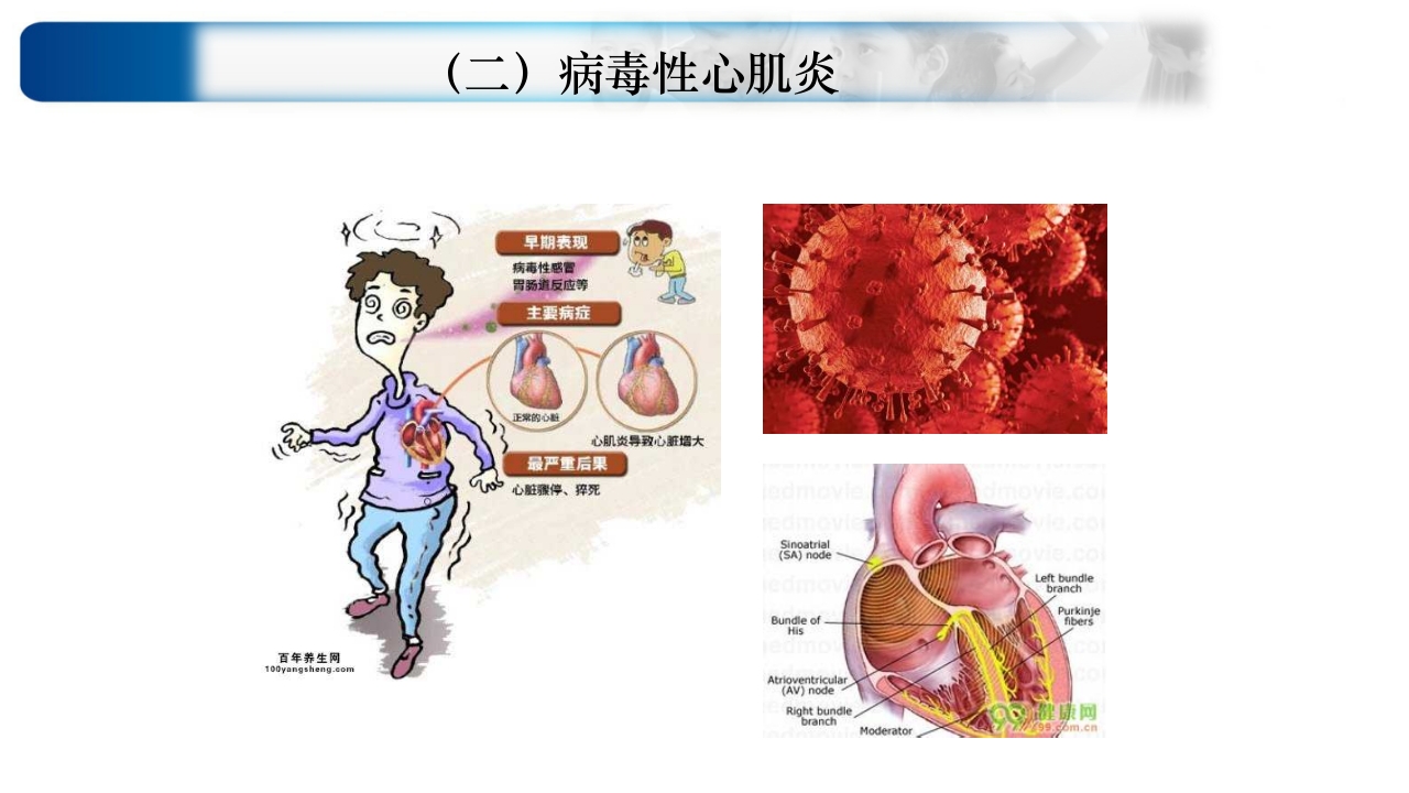 心源性休克诊治思路与进展ppt课件53