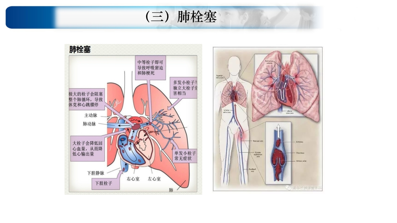 心源性休克诊治思路与进展ppt课件54