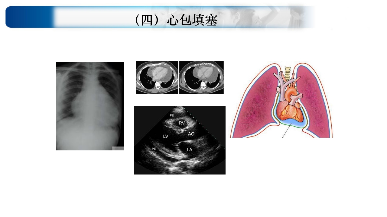 心源性休克诊治思路与进展ppt课件55
