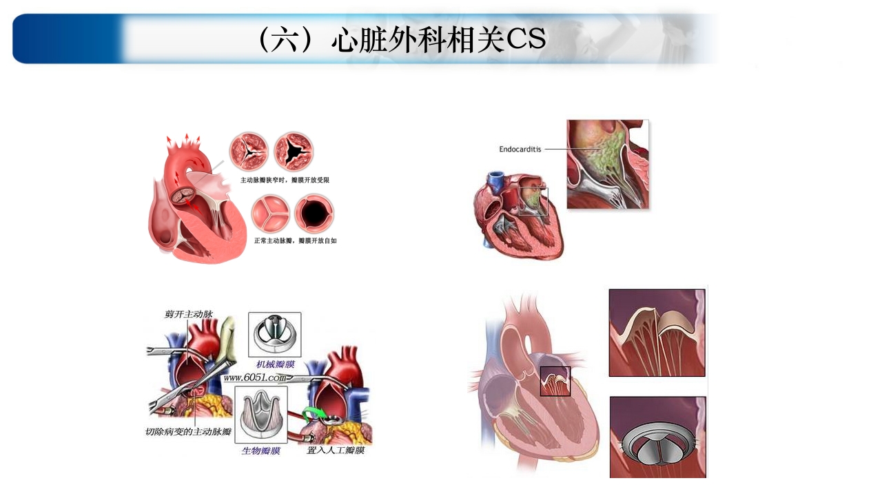 心源性休克诊治思路与进展ppt课件57