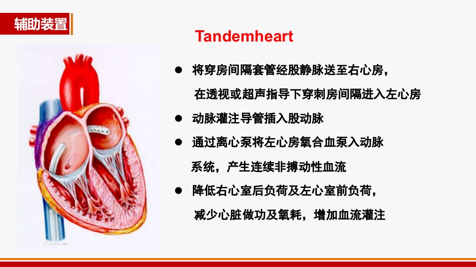 心源性休克诊治进展PPT课件44