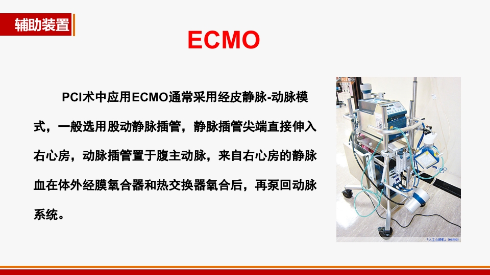 心源性休克诊治进展PPT课件48