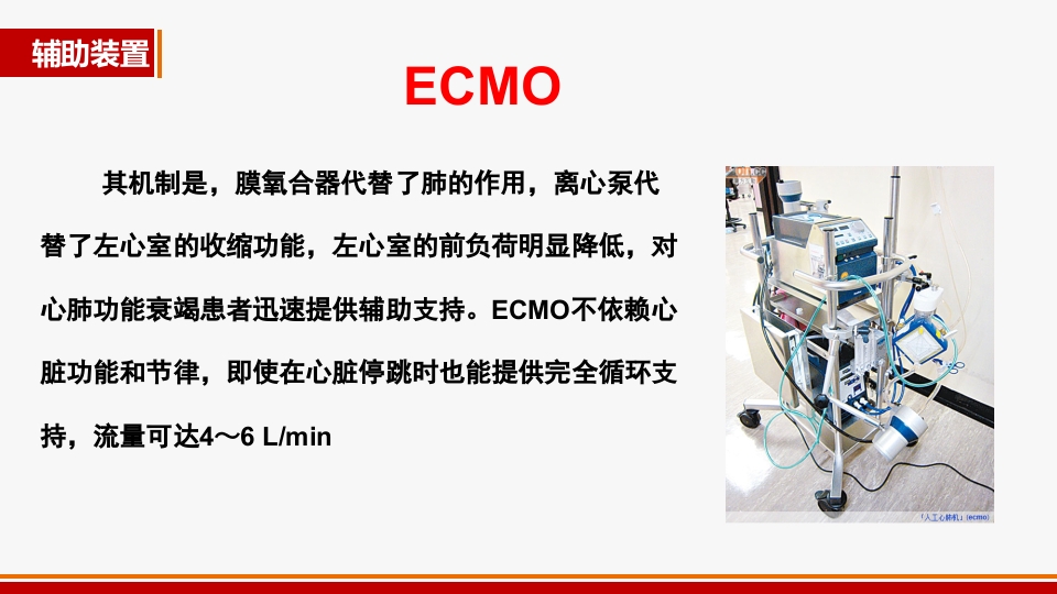 心源性休克诊治进展PPT课件49