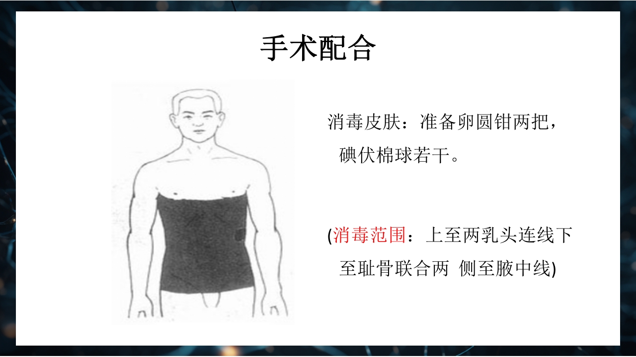 腹腔镜下胆囊切除术手术配合PPT课件10