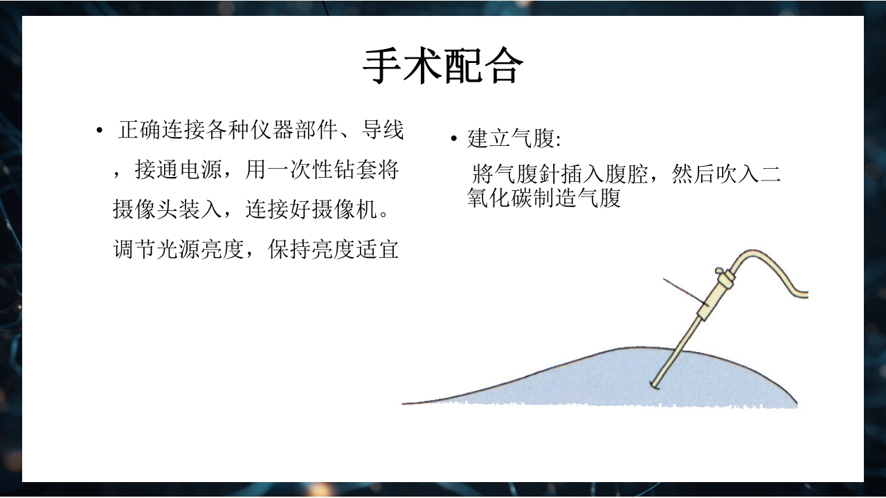 腹腔镜下胆囊切除术手术配合PPT课件12