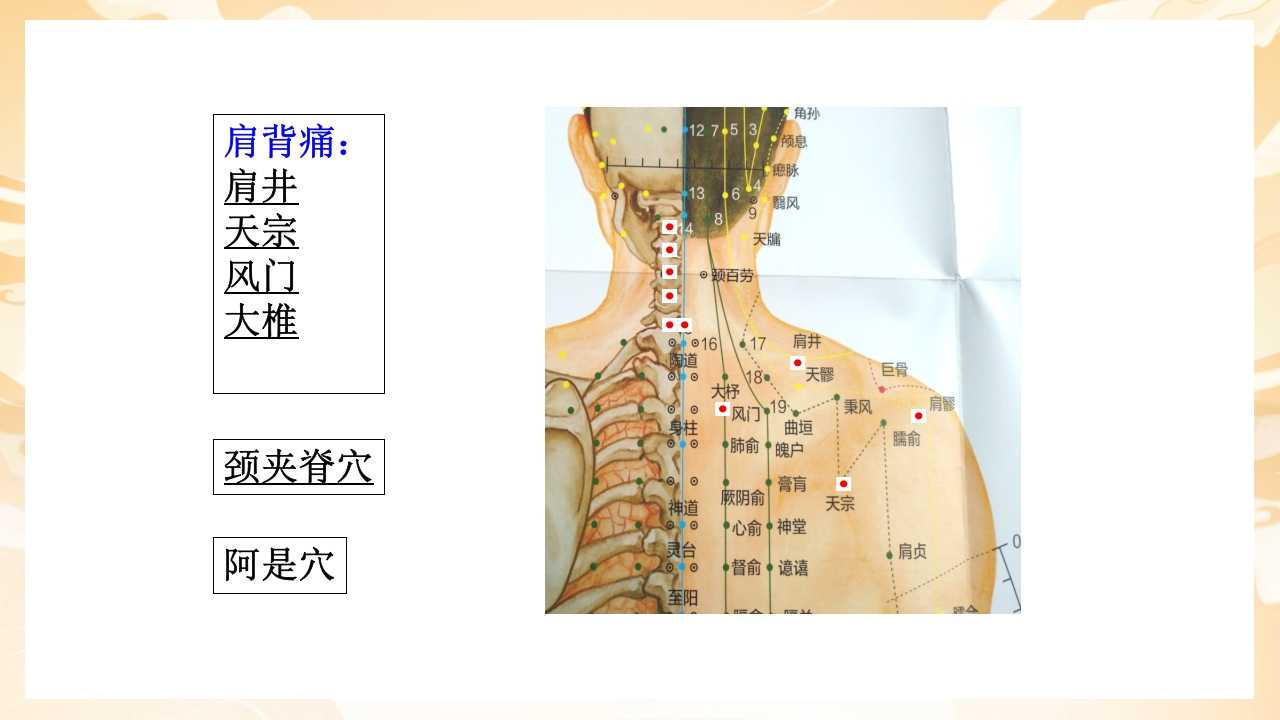 颈肩腰腿痛穴位讲解图PPT课件15