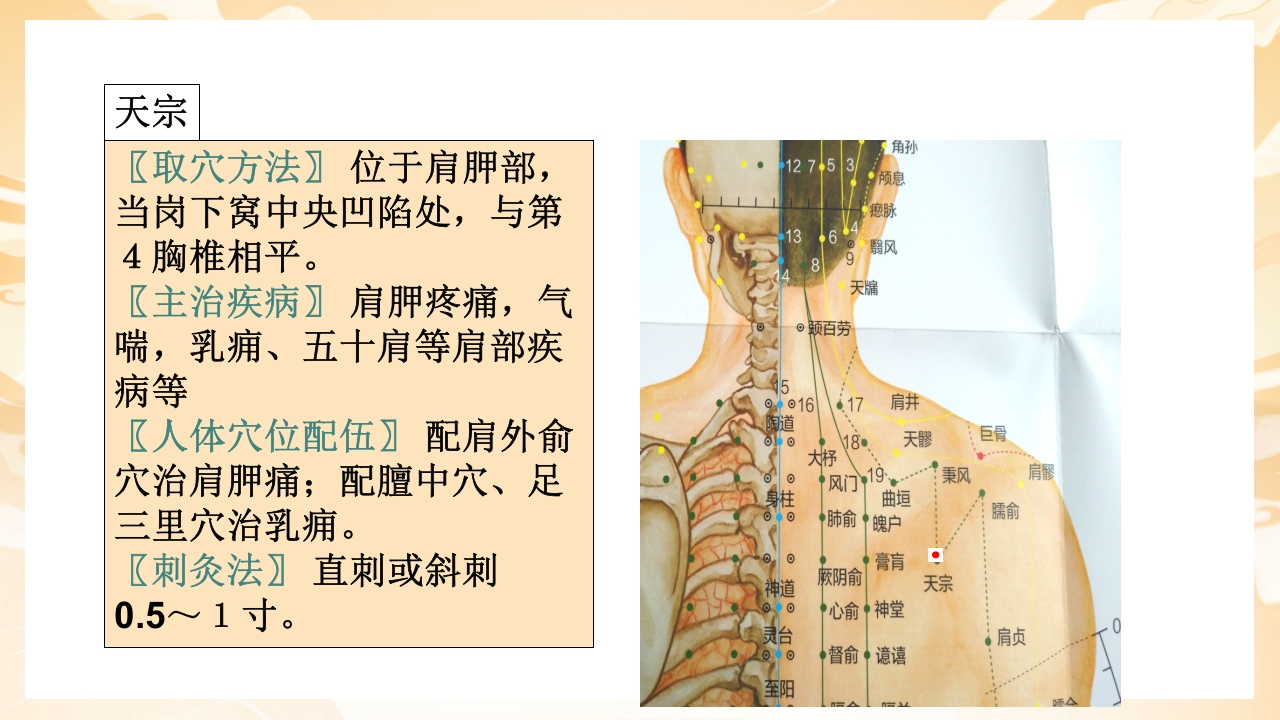 颈肩腰腿痛穴位讲解图PPT课件17