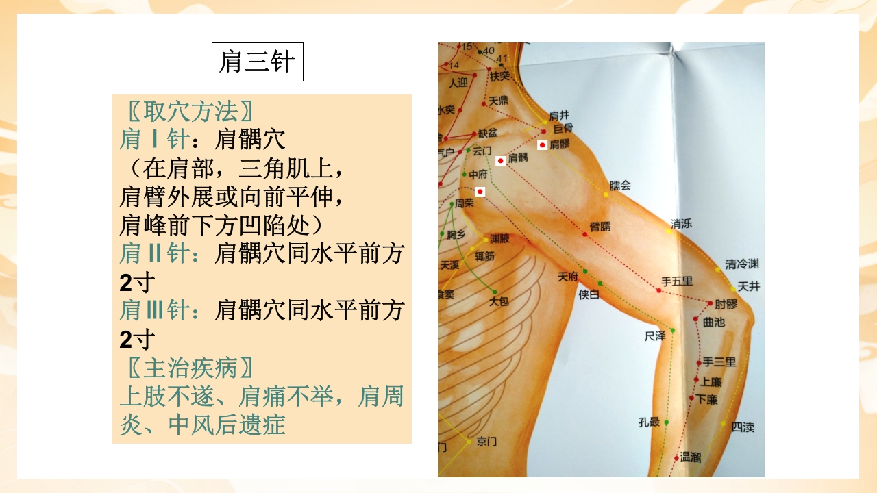颈肩腰腿痛穴位讲解图PPT课件33