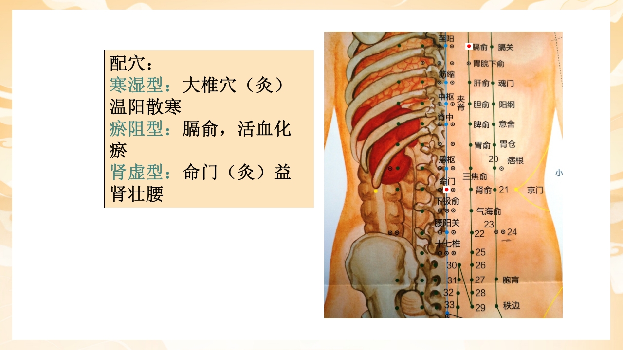 颈肩腰腿痛穴位讲解图PPT课件47