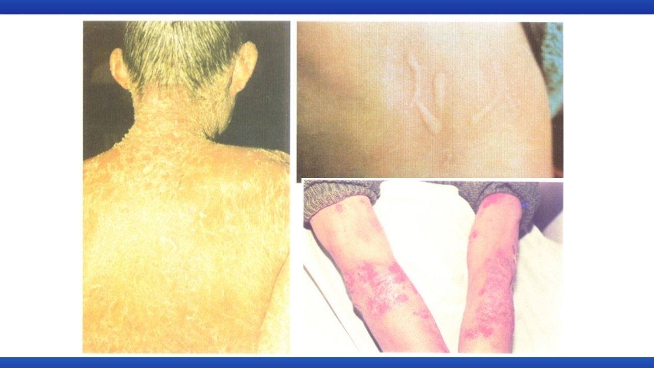 过敏性休克的识别及处理流程PPT课件11