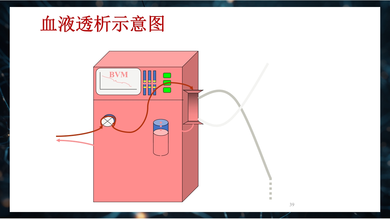 慢性肾衰竭PPT课件39
