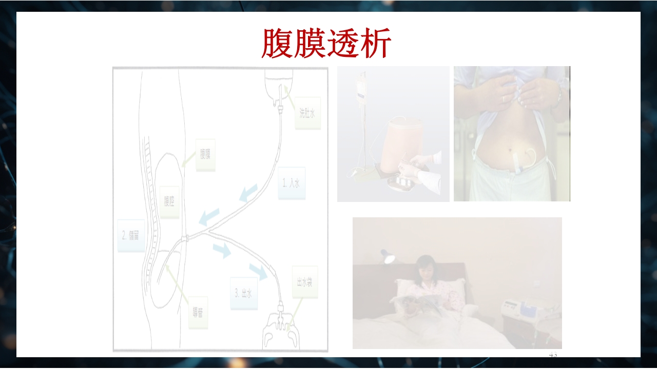 慢性肾衰竭PPT课件43