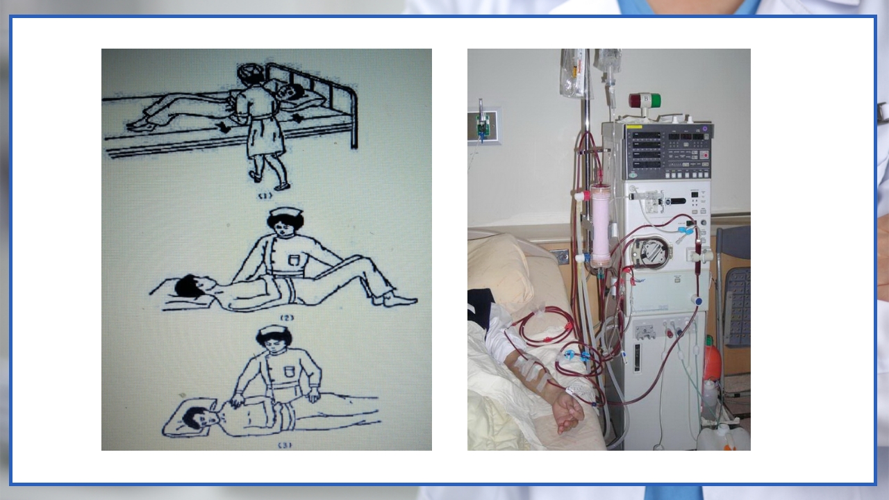 流行性出血热的个案护理PPT课件12