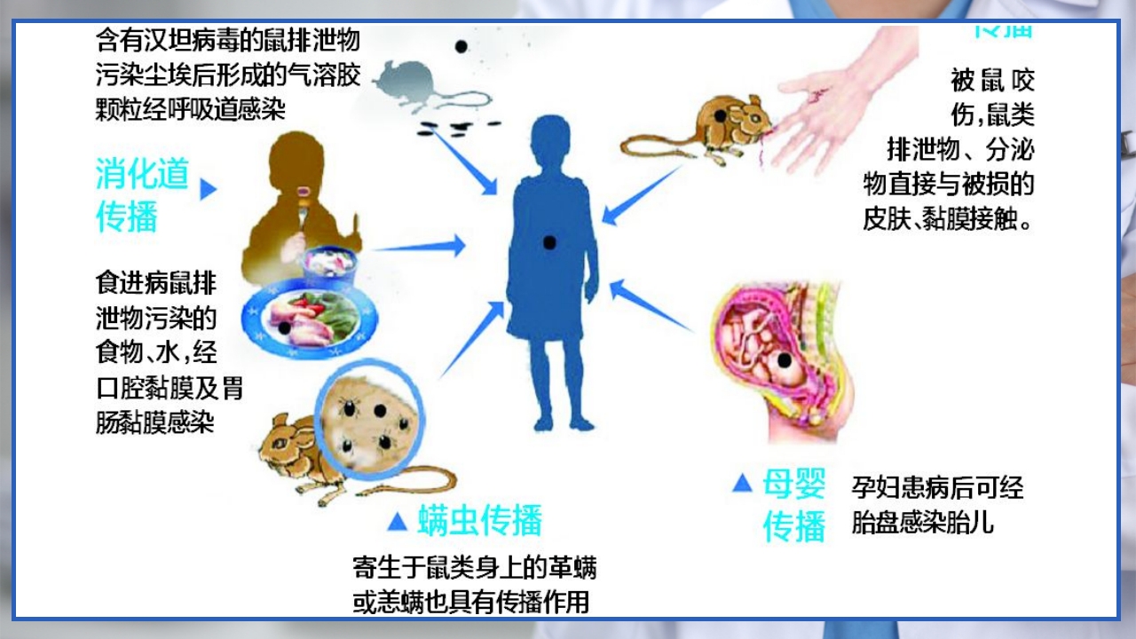 流行性出血热的个案护理PPT课件4