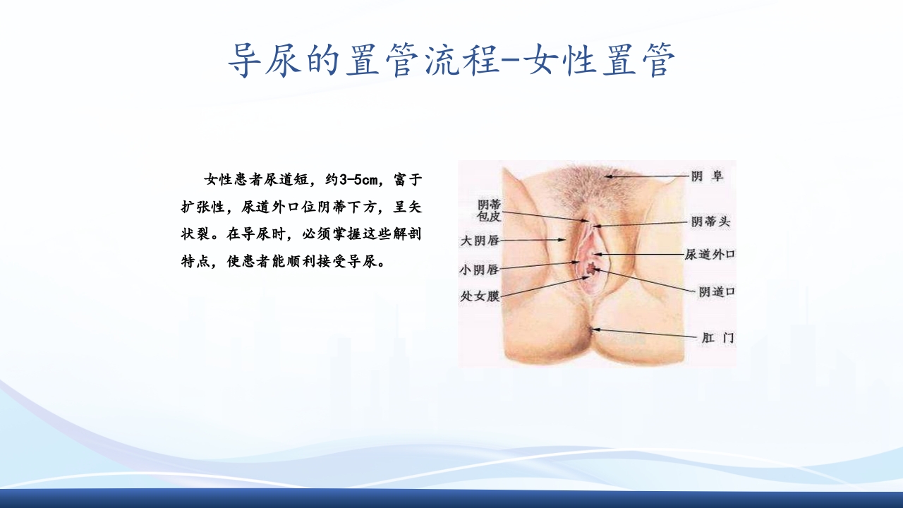 尿管护理PPT课件10