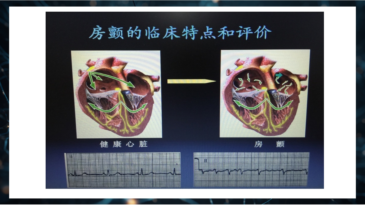 股骨粗隆间骨折护理查房PPT课件24