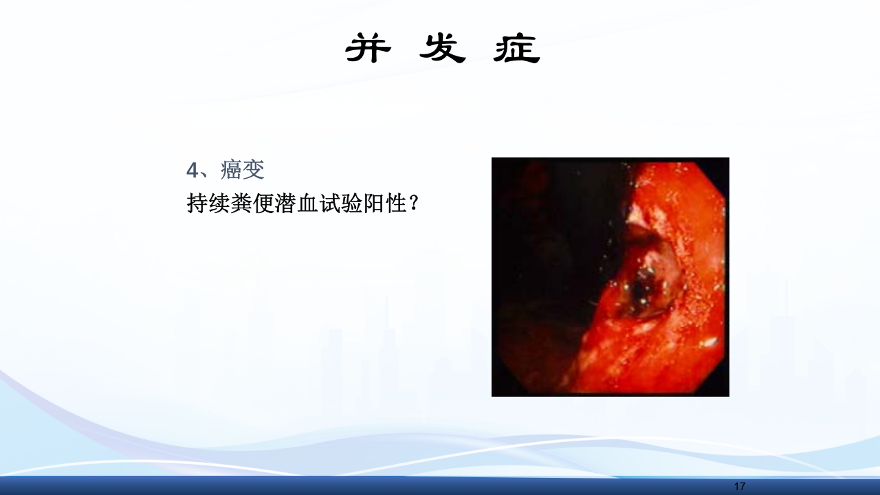 消化性溃疡的护理PPT课件17