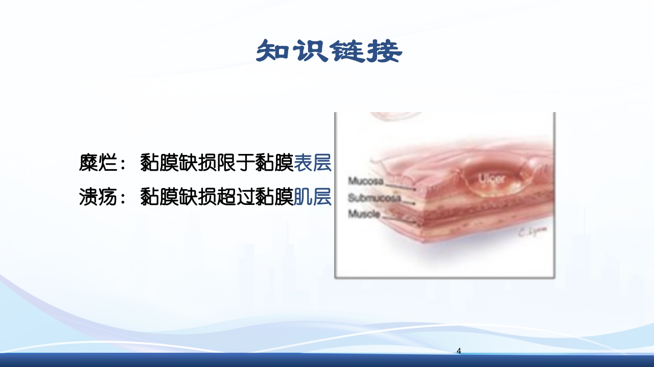 消化性溃疡的护理PPT课件4